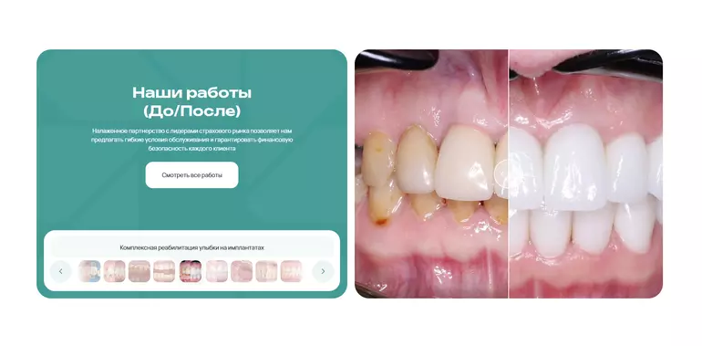 Слайд